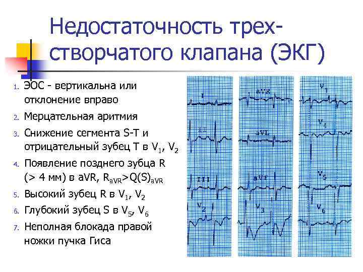 Эос отклонена вправо