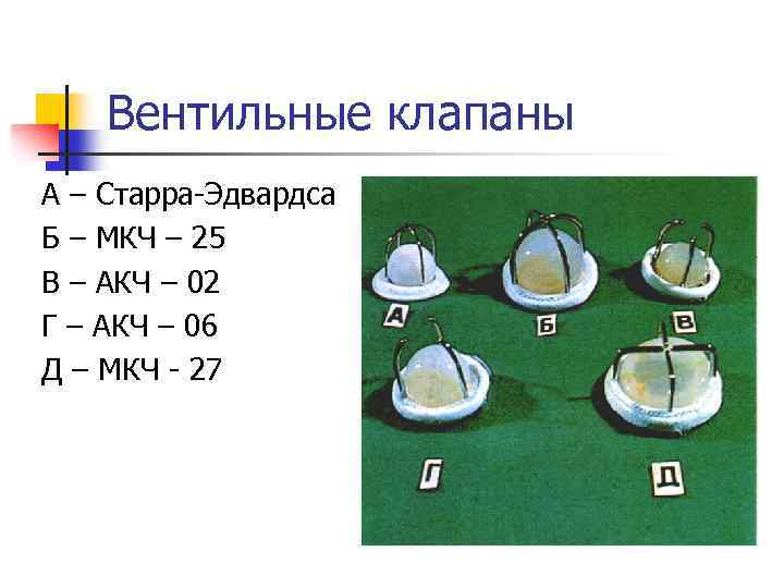 Вентильные клапаны А – Старра-Эдвардса Б – МКЧ – 25 В – АКЧ –