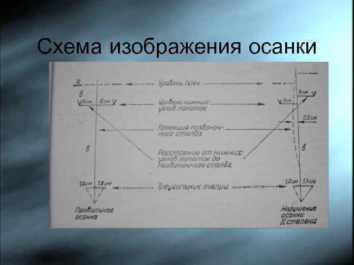 Схема изображения осанки 