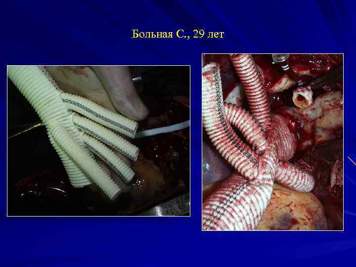 Больная С. , 29 лет 