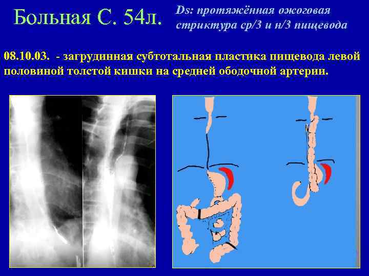 Заболевания и повреждения пищевода презентация