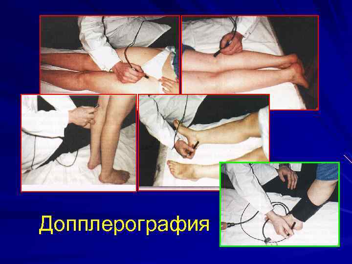 Допплерография 