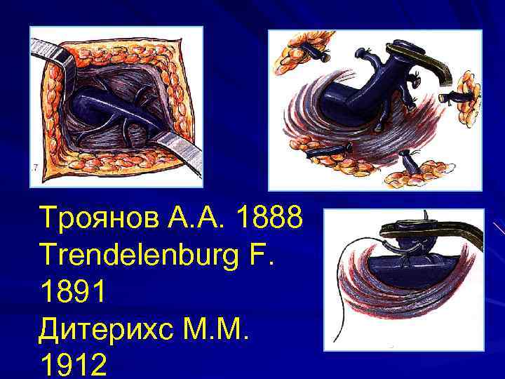 Троянов А. А. 1888 Trendelenburg F. 1891 Дитерихс М. М. 1912 