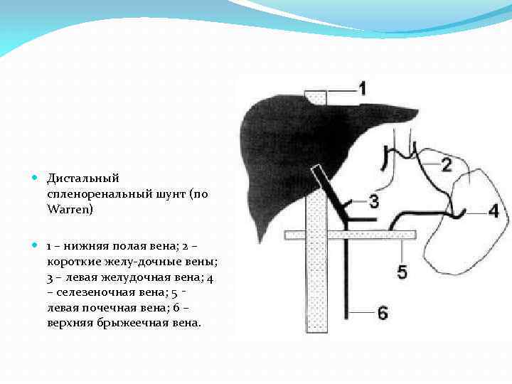  Дистальный спленоренальный шунт (по Warren) 1 – нижняя полая вена; 2 – короткие