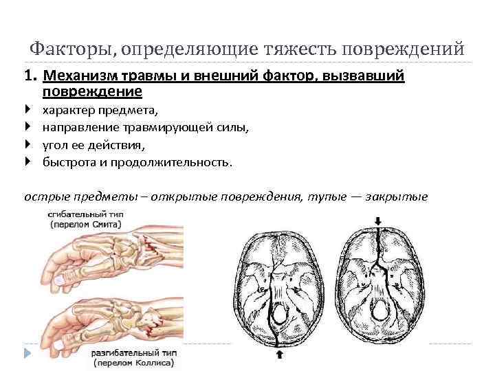 Факторы, определяющие тяжесть повреждений 1. Механизм травмы и внешний фактор, вызвавший повреждение характер предмета,