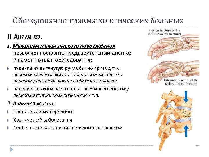 Обследование травматологических больных II Анамнез. 1. Механизм механического повреждения позволяет поставить предварительный диагноз и