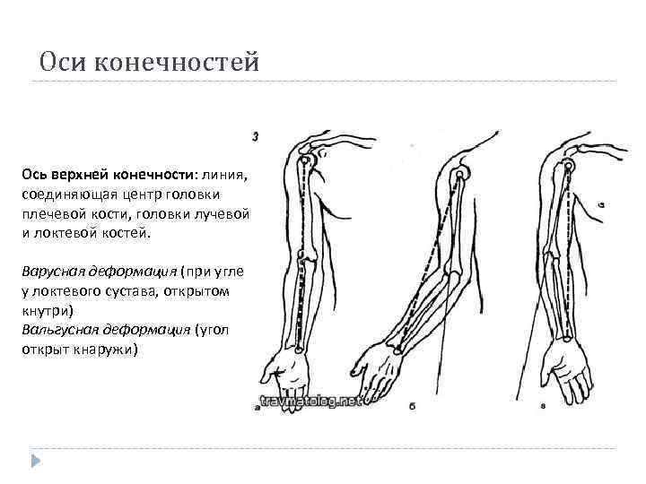 Оси конечностей Ось верхней конечности: линия, соединяющая центр головки плечевой кости, головки лучевой и