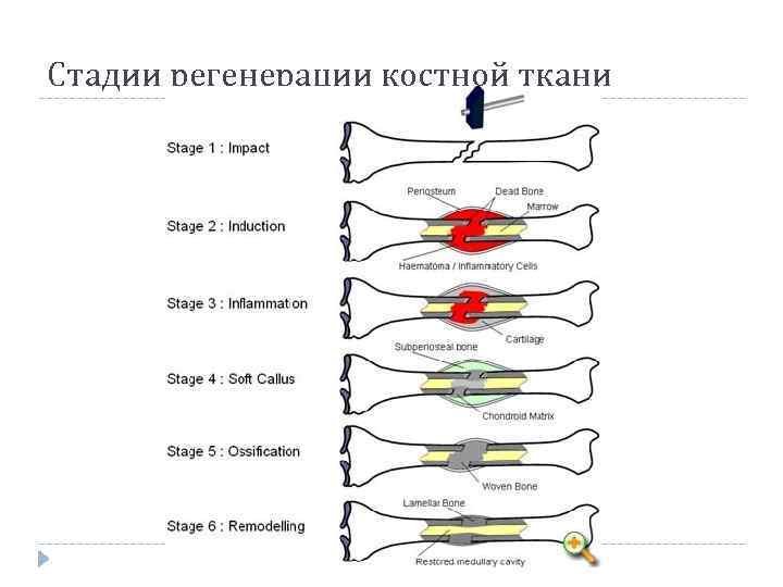 Стадии регенерации костной ткани 