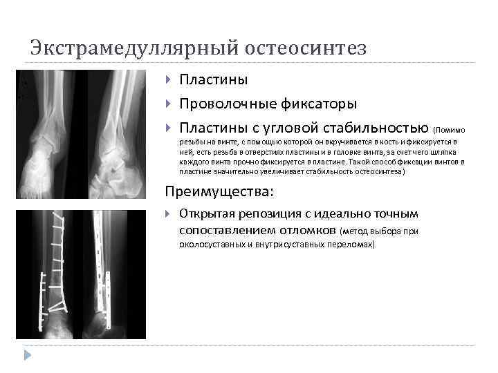 Очаги экстрамедуллярного кроветворения