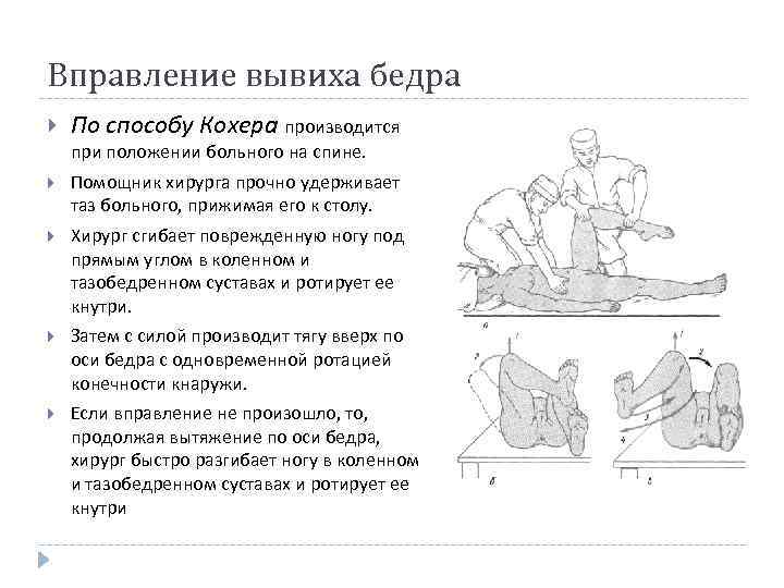 Вправление вывиха бедра По способу Кохера производится при положении больного на спине. Помощник хирурга