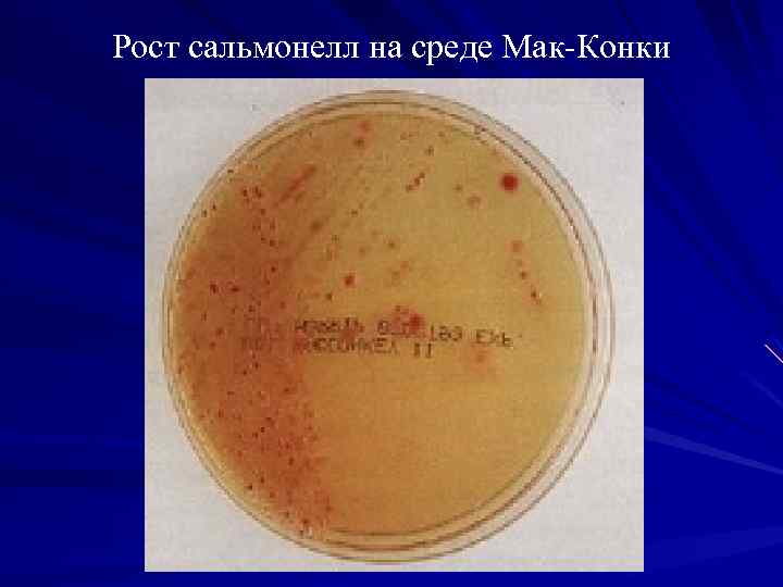 Рост сальмонелл на среде Мак-Конки 