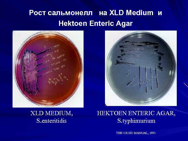 Посев на сальмонеллез. Рост сальмонелл на среде XLD. Salmonella Typhimurium на XLD. Salmonella Enteritidis - XLD-агар. Сальмонелла на XLD агаре.