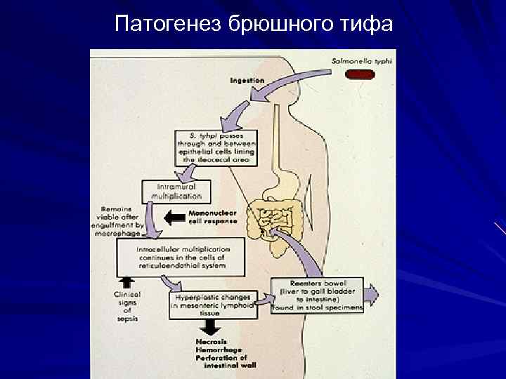 Схема патогенеза брюшного тифа