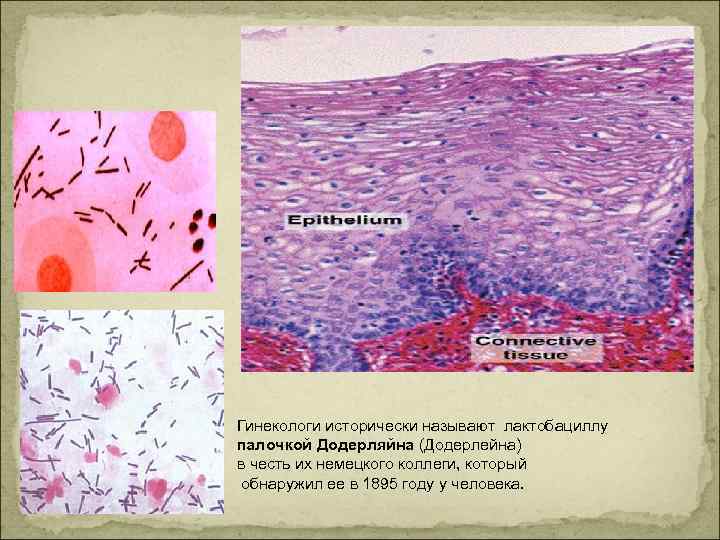 Гинекологи исторически называют лактобациллу палочкой Додерляйна (Додерлейна) в честь их немецкого коллеги, который обнаружил