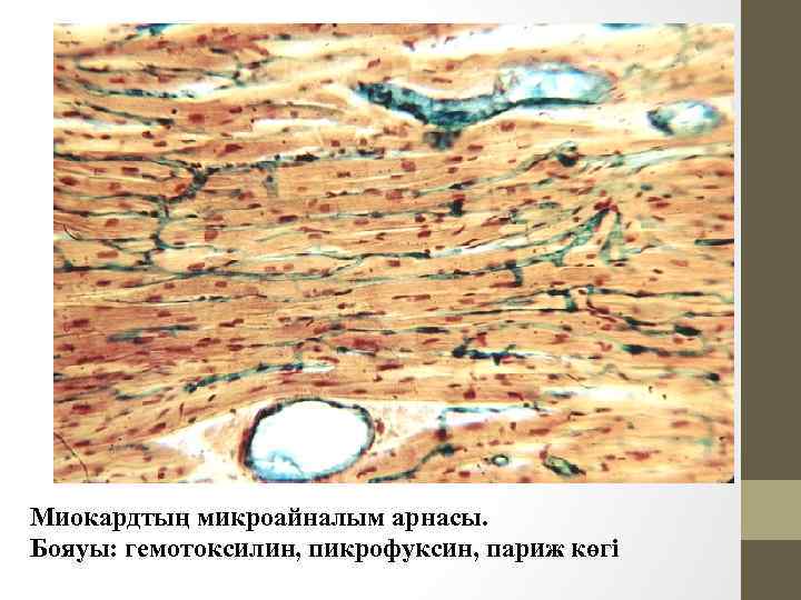 Миокардтың микроайналым арнасы. Бояуы: гемотоксилин, пикрофуксин, париж көгі 