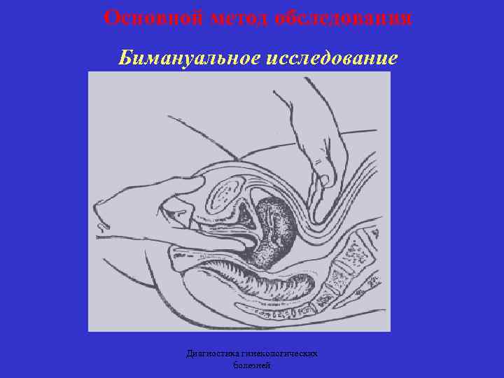 Основной метод обследования Бимануальное исследование Диагностика гинекологических болезней 