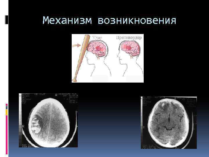 Механизм возникновения 