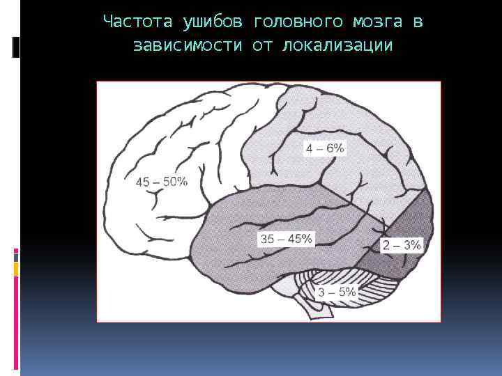 Частота ушибов головного мозга в зависимости от локализации 