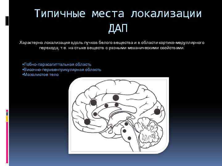Типичные места локализации ДАП Характерна локализация вдоль пучков белого вещества и в области кортико-медуллярного
