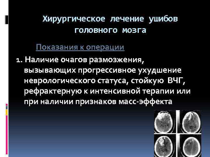 Ушиб головного мозга лечение. Ушиб головного мозга хирургическое лечение. Показания к операции при ушибе мозга. Интенсивная терапия при ушибе головного мозга. Неврологический статус при травме головы.