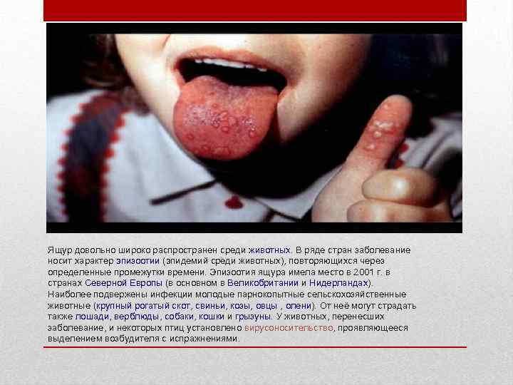 Ящур довольно широко распространен среди животных. В ряде стран заболевание носит характер эпизоотии (эпидемий