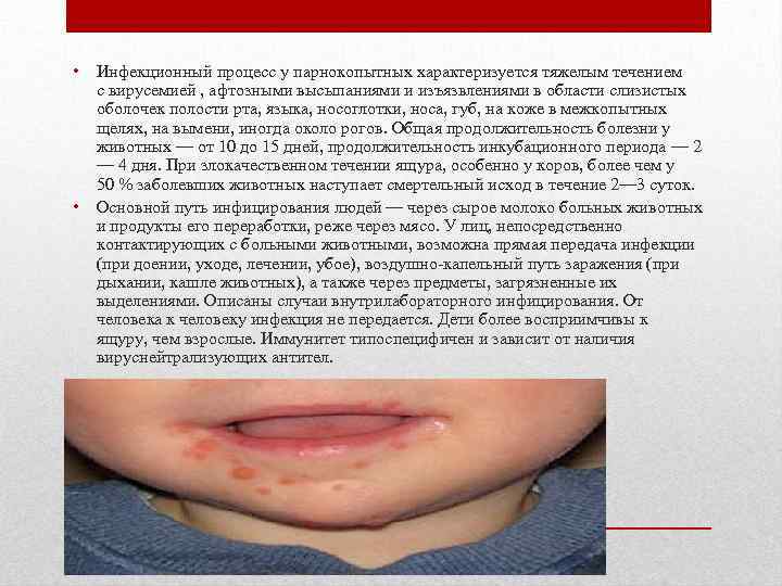  • Инфекционный процесс у парнокопытных характеризуется тяжелым течением с вирусемией , афтозными высыпаниями