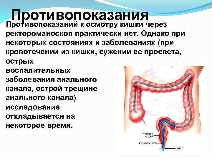 Противопоказания Противопоказаний к осмотру кишки через ректороманоскоп практически нет. Однако при некоторых состояниях и