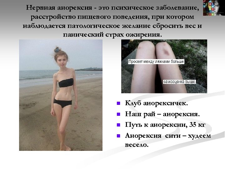 Нервная анорексия - это психическое заболевание, расстройство пищевого поведения, при котором наблюдается патологическое желание