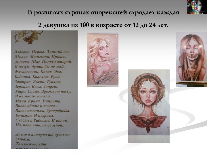 В развитых странах анорексией страдает каждая 2 девушка из 100 в возрасте от 12