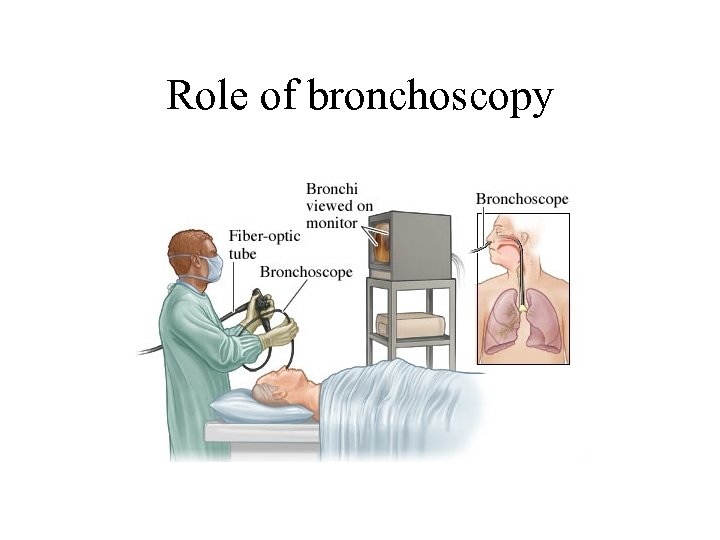 Role of bronchoscopy 