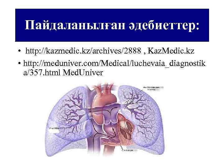 Пайдаланылған әдебиеттер: • http: //kazmedic. kz/archives/2888 , Kaz. Medic. kz • http: //meduniver. com/Medical/luchevaia_diagnostik