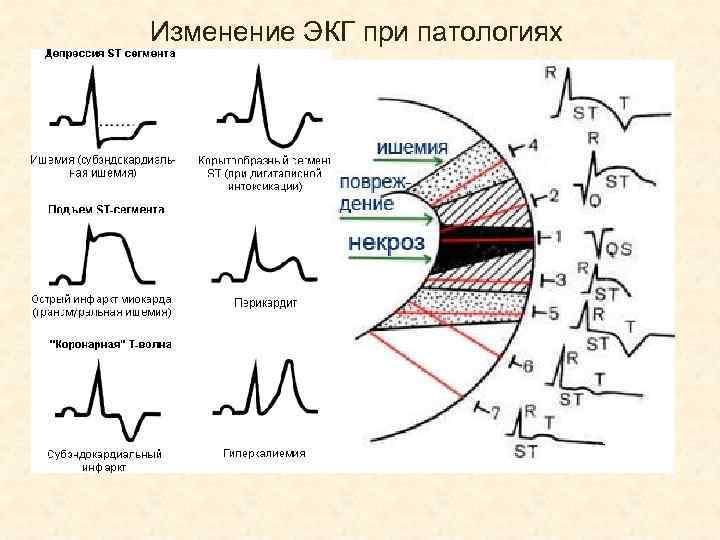 Рисунок кардиограммы в норме - 96 фото