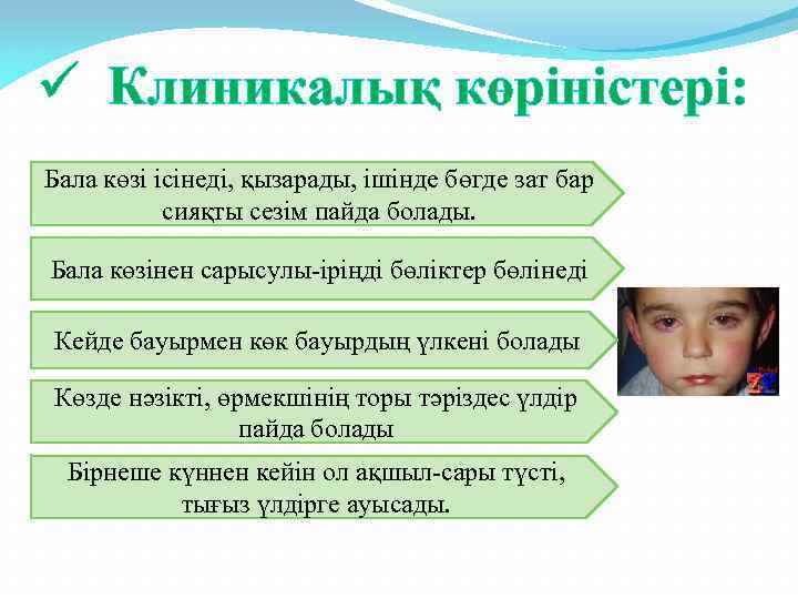 ü Клиникалық көріністері: Бала көзі ісінеді, қызарады, ішінде бөгде зат бар сияқты сезім пайда