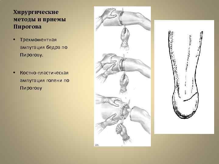 Пирогов операции по пирогову