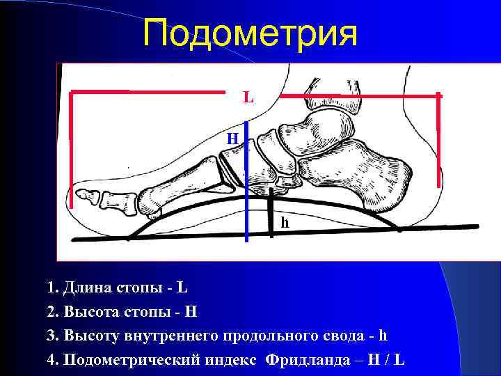 Внутренний свод стопы