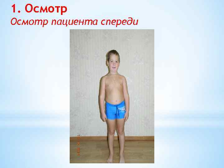 1. Осмотр пациента спереди 