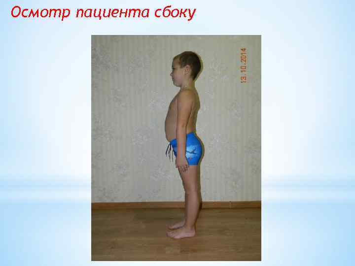 Осмотр пациента сбоку 