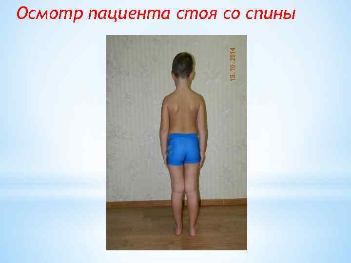 Осмотр пациента стоя со спины 