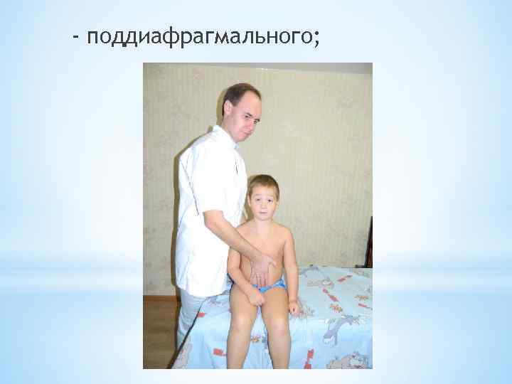 - поддиафрагмального; 