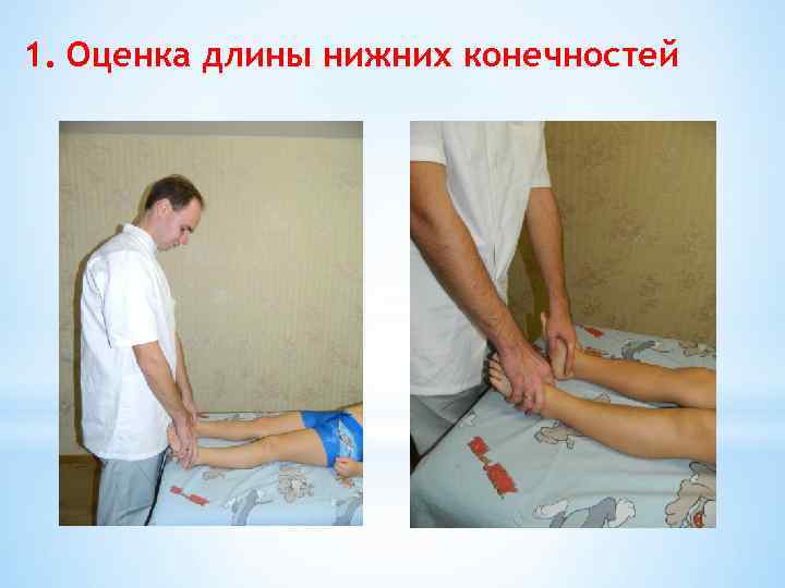 1. Оценка длины нижних конечностей 