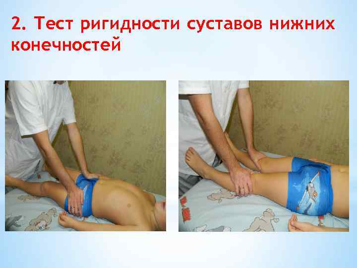 2. Тест ригидности суставов нижних конечностей 