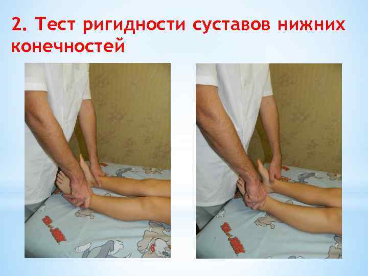 2. Тест ригидности суставов нижних конечностей 