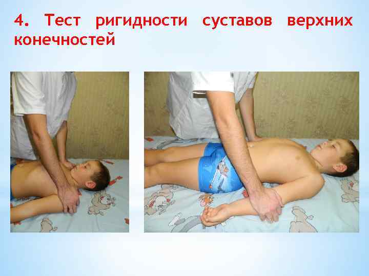 4. Тест ригидности суставов верхних конечностей 