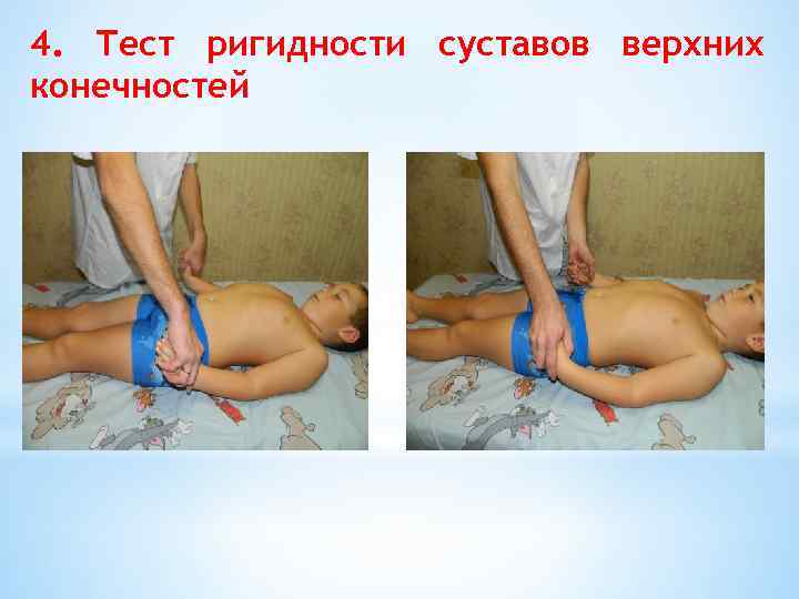 4. Тест ригидности суставов верхних конечностей 