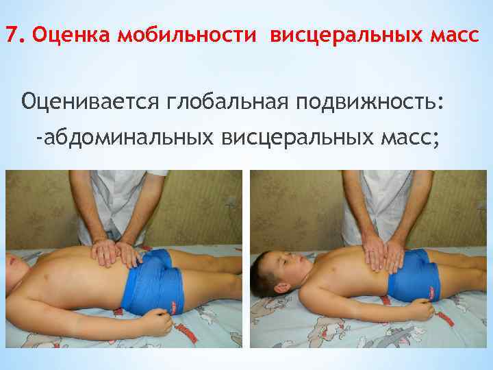 7. Оценка мобильности висцеральных масс Оценивается глобальная подвижность: -абдоминальных висцеральных масс; 