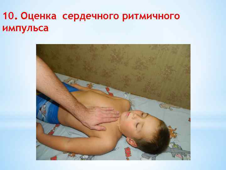 10. Оценка сердечного ритмичного импульса 