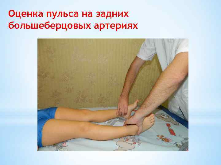 Оценка пульса на задних большеберцовых артериях 