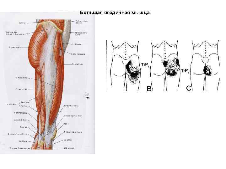 Большая ягодичная мышца 