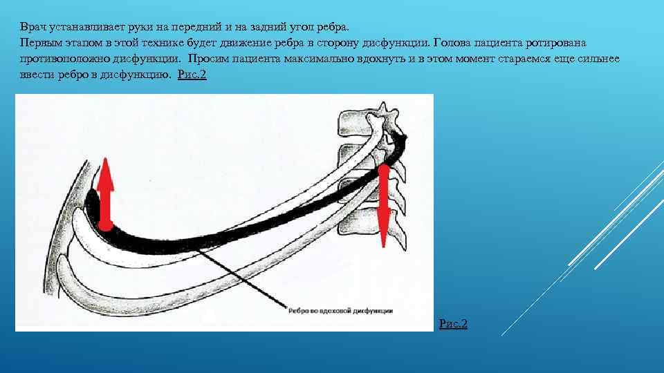 Врач устанавливает руки на передний и на задний угол ребра. Первым этапом в этой