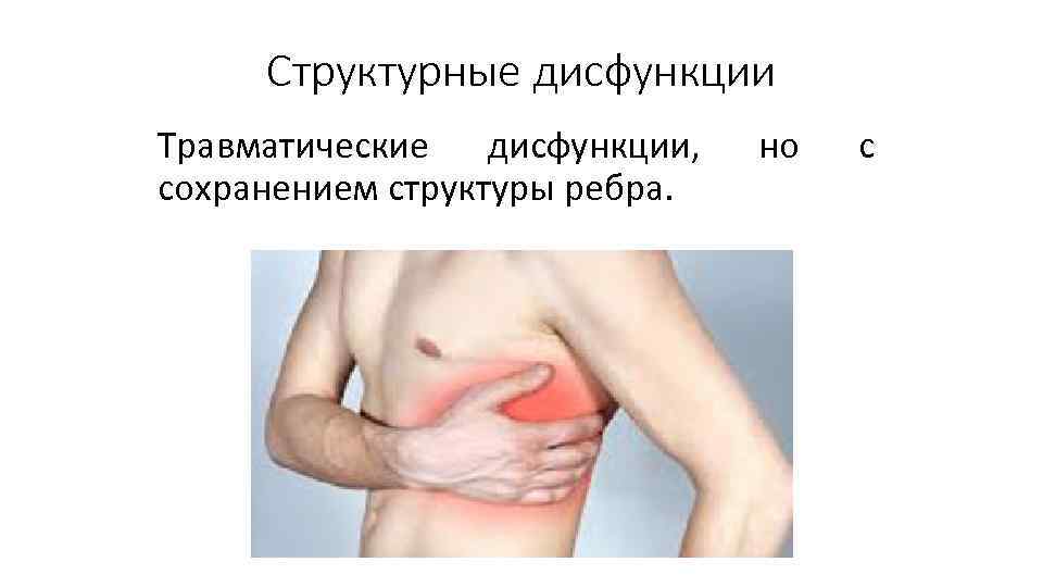 Структурные дисфункции Травматические дисфункции, сохранением структуры ребра. но с 